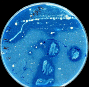 bacteriapetrie.gif (25050 bytes)